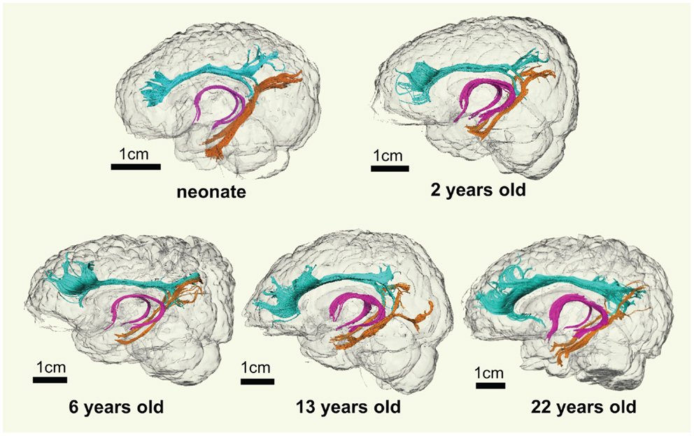 Shows illustrations of the brain as it develops over age. 